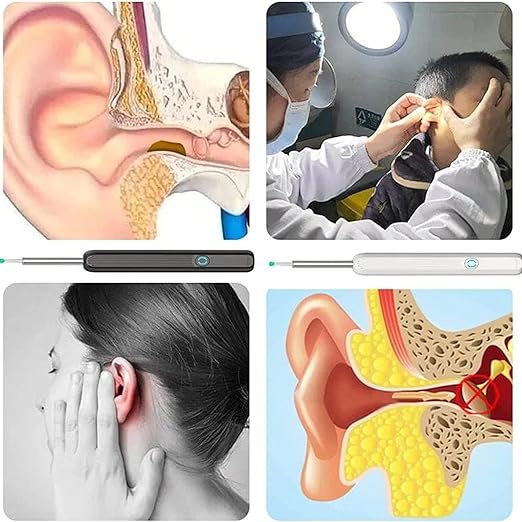 71kC0iSSZsL._AC_SX522_